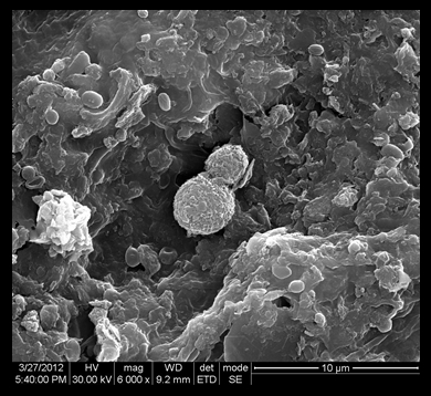 bacteria imagen